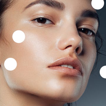 how to get rid of whiteheads, according to dermatologists